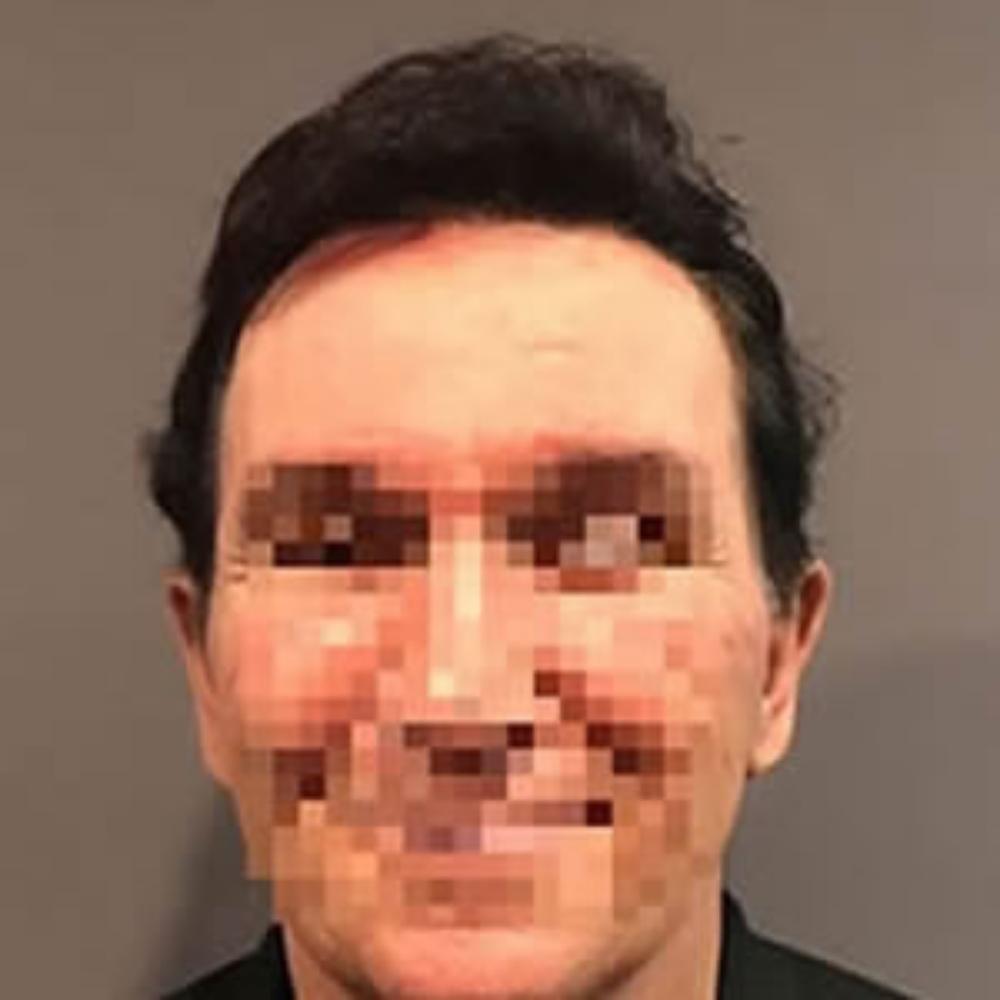 Men’s Hair System – After Men's Hair System - After