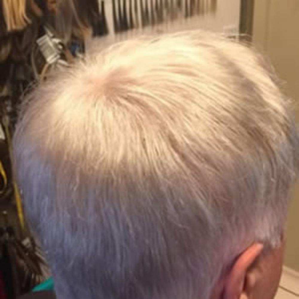 Men’s Hair System – After Men's Hair System - After