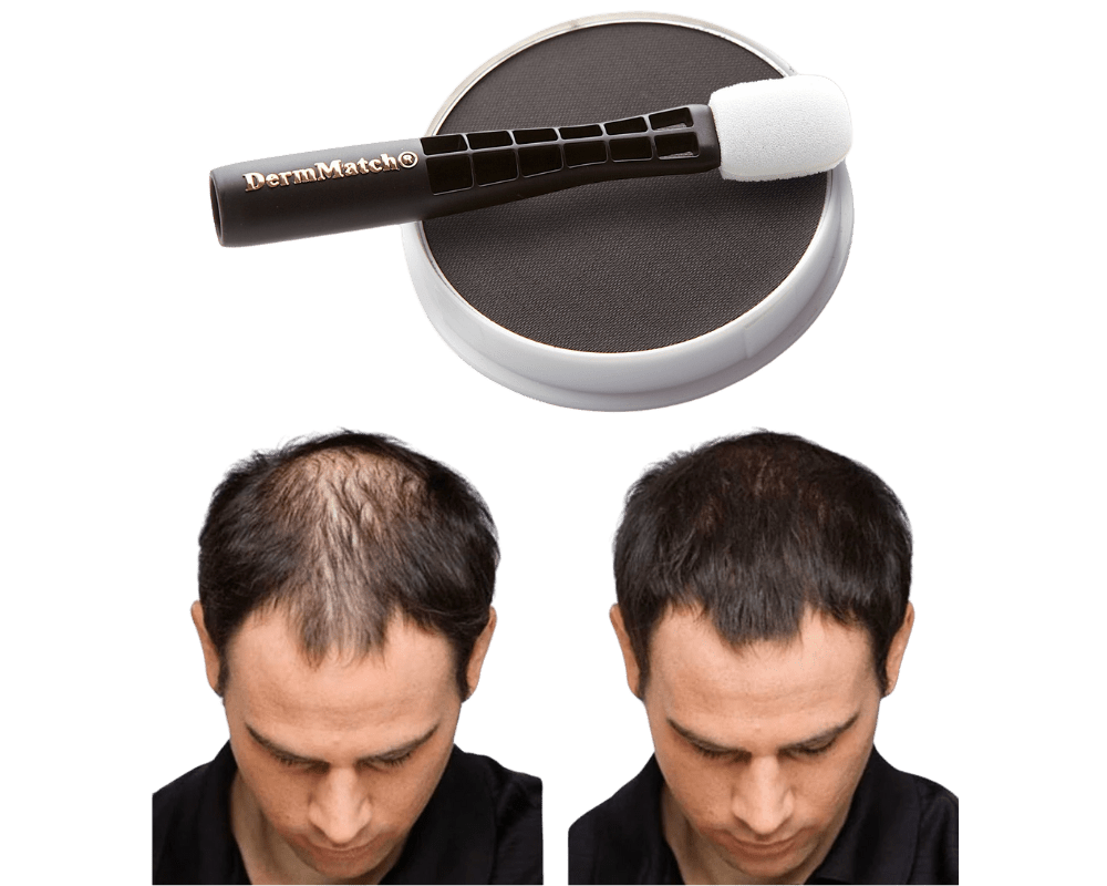 DermMatch Hair Regrowth Products DermMatch Hair Regrowth Products