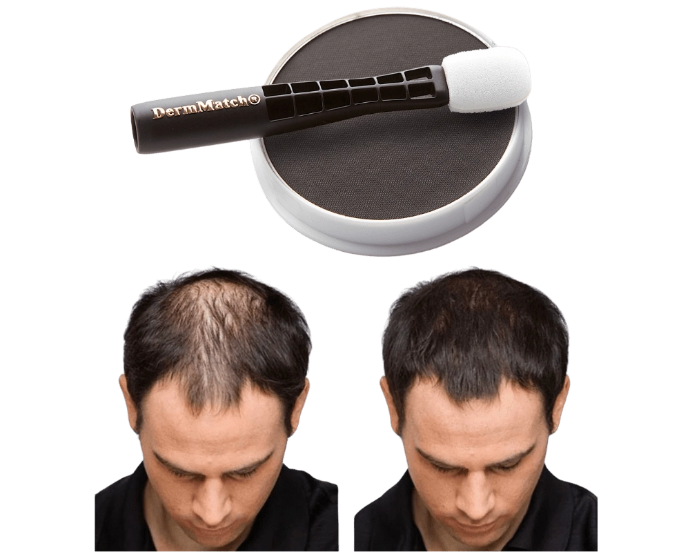 DermMatch Hair Regrowth Products