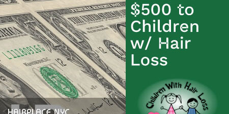 Donated $500 To Children With Hair Loss (Blog)